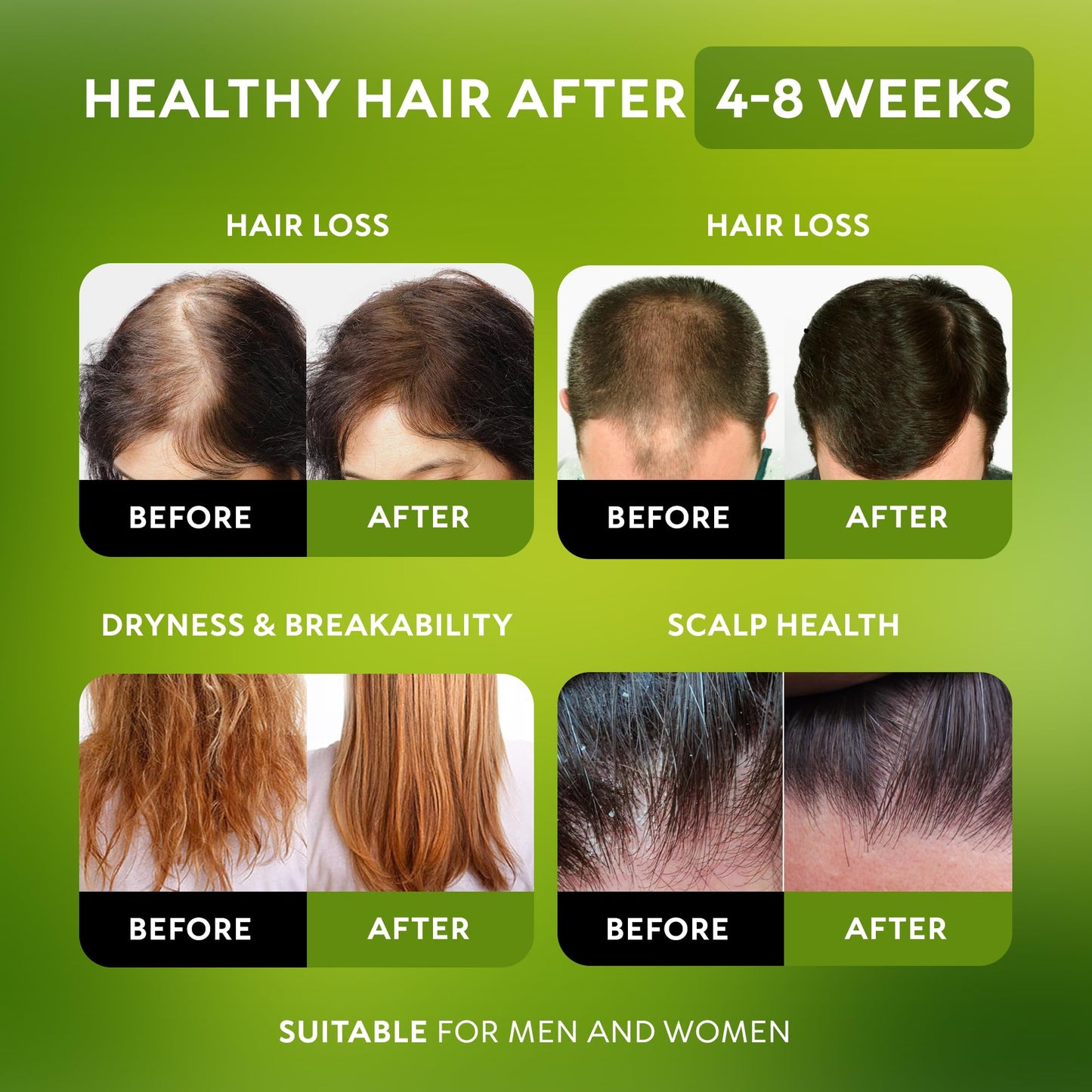Batana Oil for Hair Growth - 100% Raw & Organic Dr Sebi Batana Oil - Cold-Pressed & Pure Unrefined Batana Hair Mask for Women & Men - Enhances Hair Thickness, Prevents Loss, Repairs Split Ends