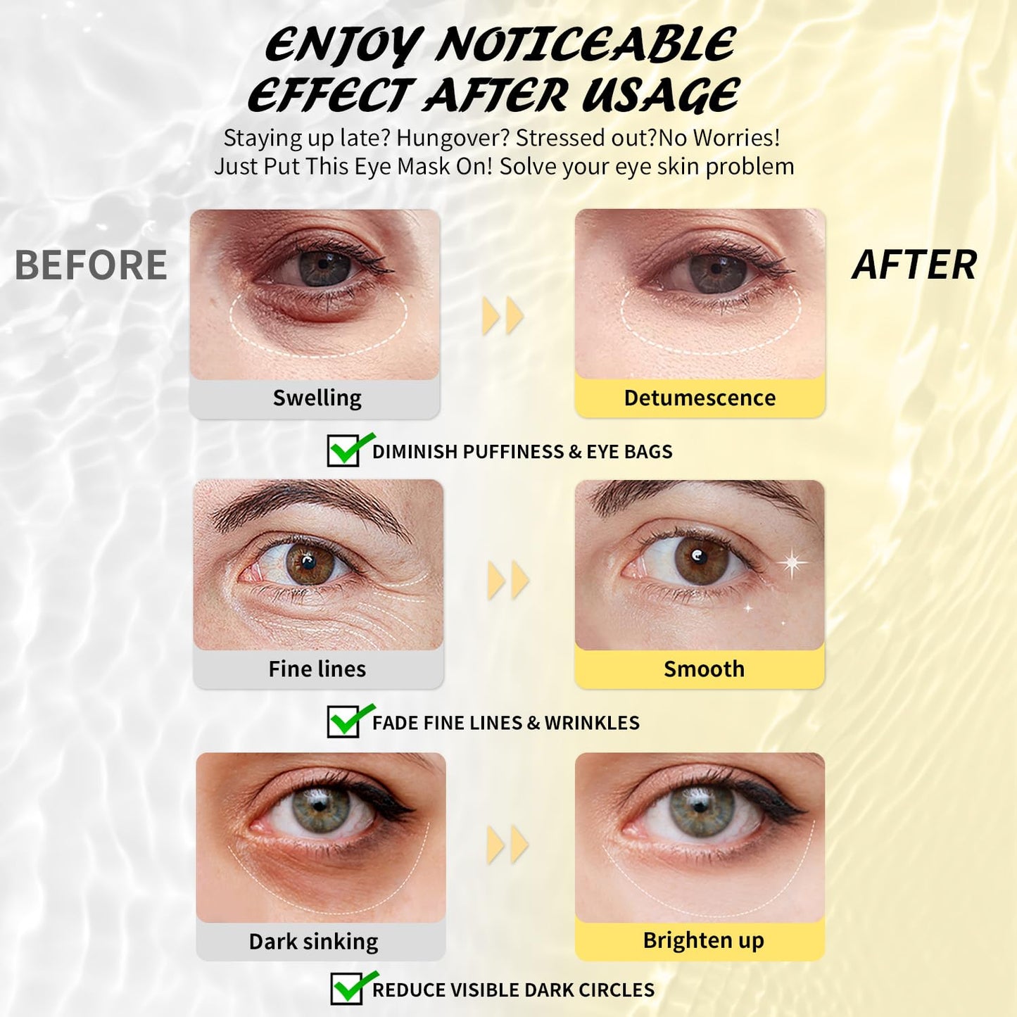 Maskiss Under Eye Patches (8 Pairs), Caffeine Eye Masks for Dark Circles Puffy Eyes Undereye Bags, Collagen Eye Patches for Wrinkles and Puffiness, Skin Care Gift for Her