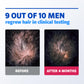 Men's Rogaine 5% Minoxidil Foam for Hair Regrowth, Topical Hair Loss Treatment for Men to Regrow Fuller, Thicker Hair, Unscented Minoxidil Topical Aerosol, 3-Month Supply, 3 x 2.11 oz