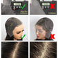 SKINLIKE Real HD Lace Frontal Wig Human Hair Full 13x4 Swiss HD&Parting MAX&&PRE Plucked&Tiny Knots&Full 200 Density Blunt Cut Bob Wig Human Hair Lace Front Wigs Straight For Black Women 14 Inch